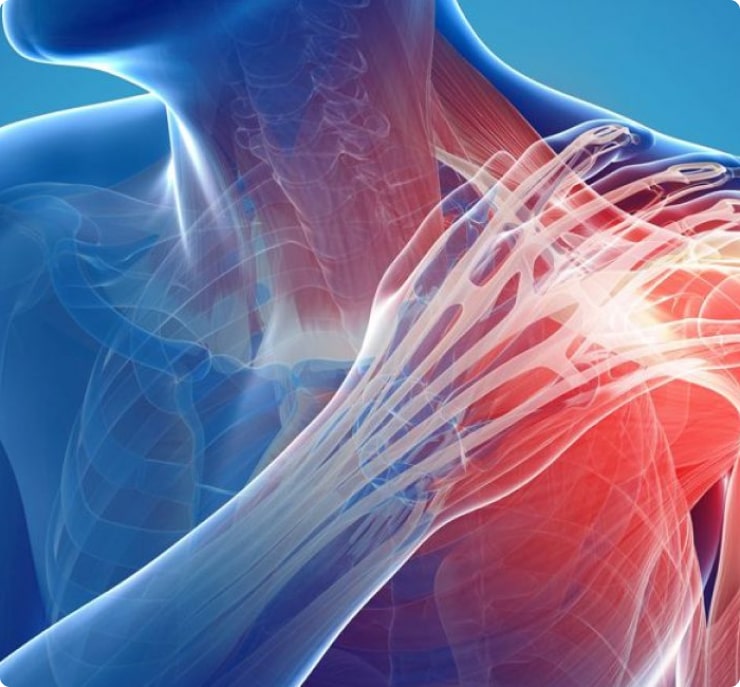 Joint Conditions Chicago | Joint Injury Treatment | Shoulder Pain